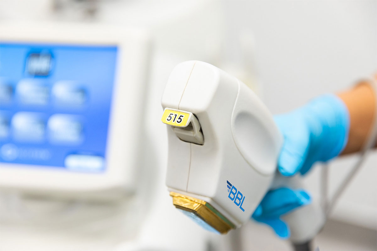 Sciton BBL device in use at Paradise Dermatology in Sarasota for brown spot treatment